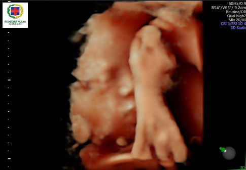 Anindya Safitri profile icon