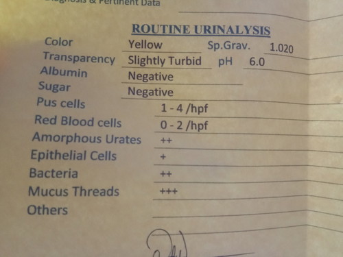 urinalysis