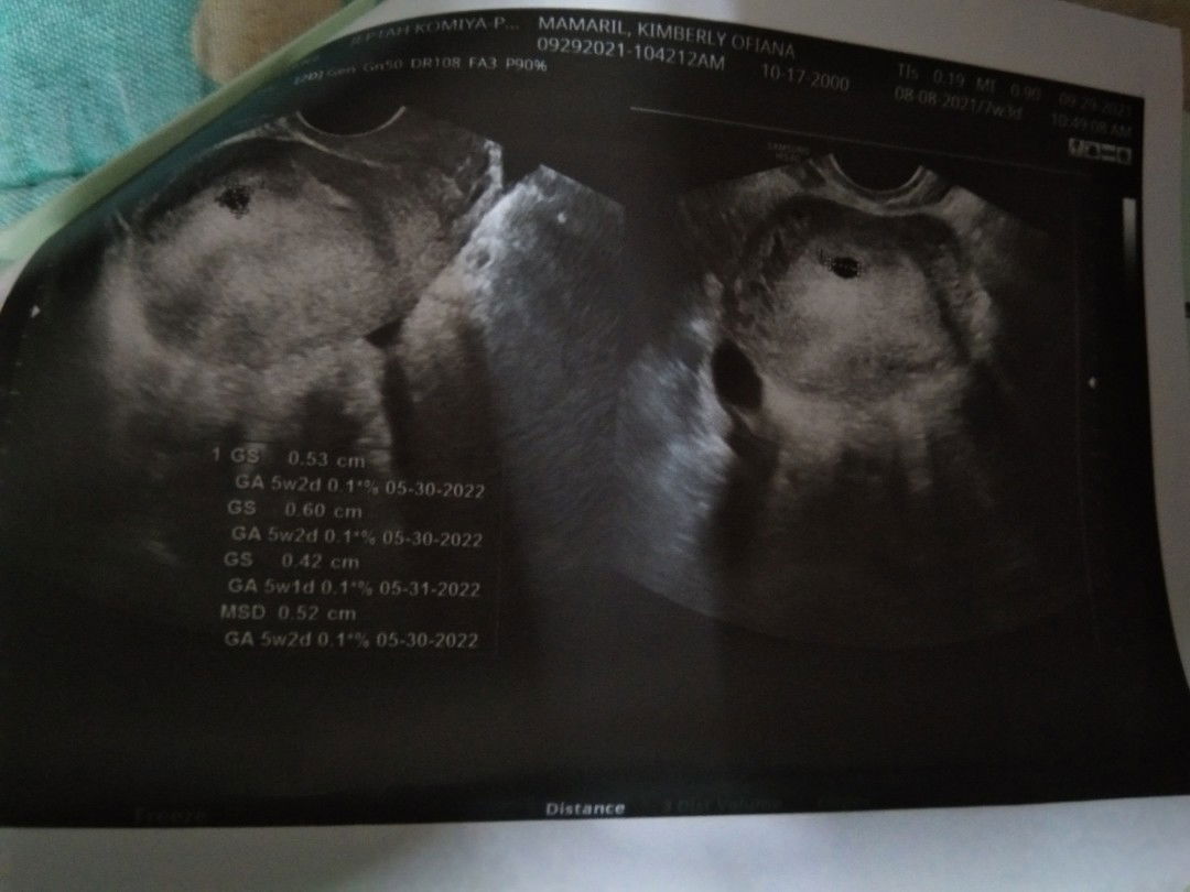 Kmmy Ofn profile icon