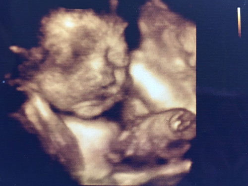 สอบถามภาพซาว 4มิติ