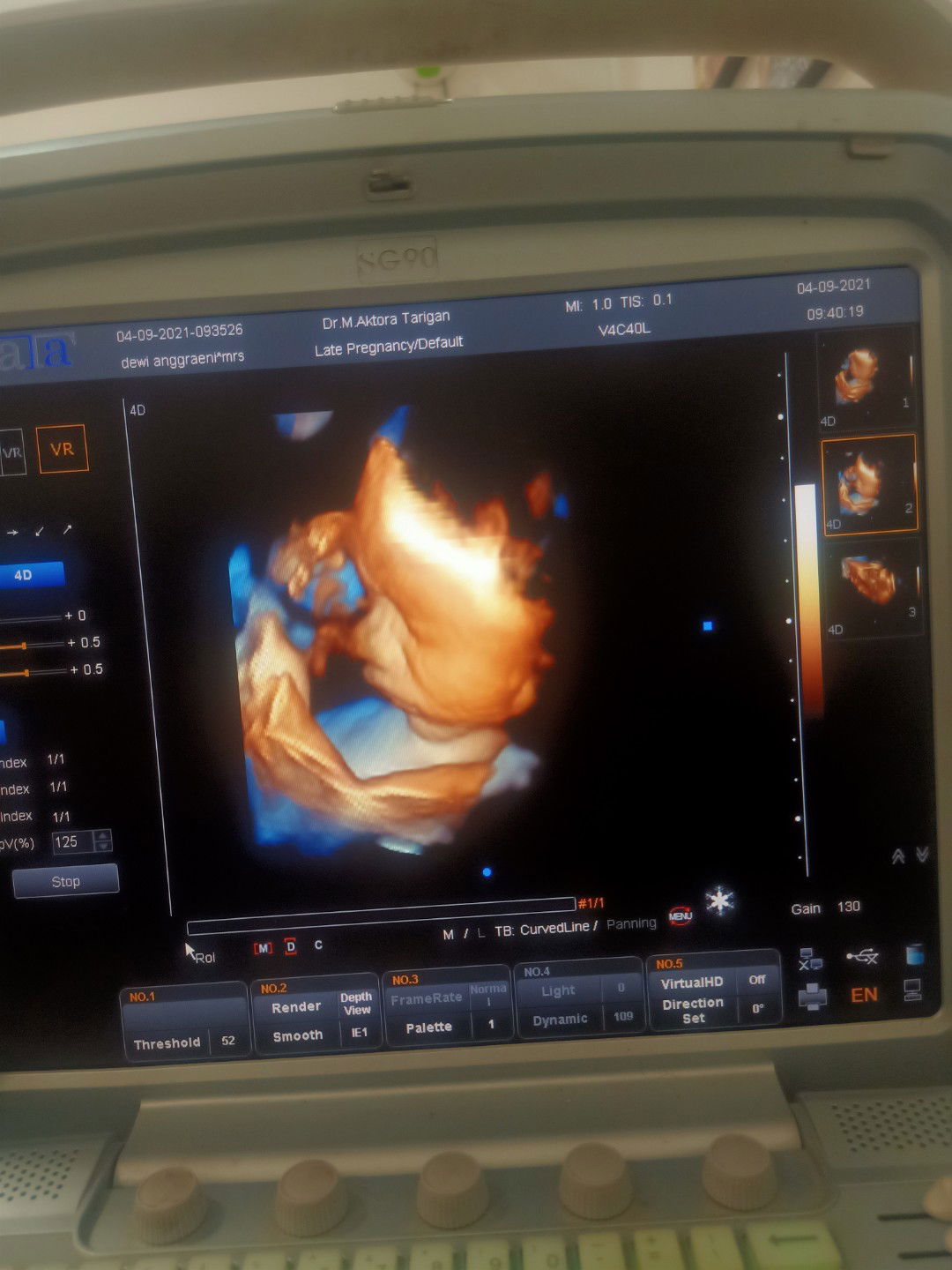 dewi anggraeni profile icon