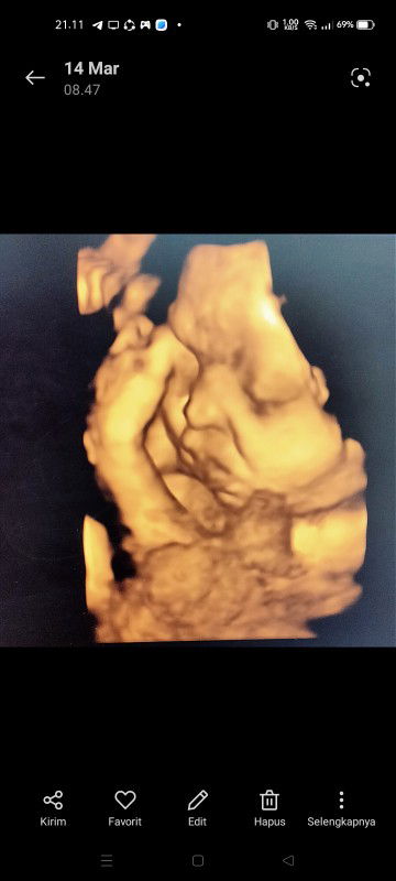 Isnaini Agustin Fauziah profile icon