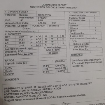 question lang po