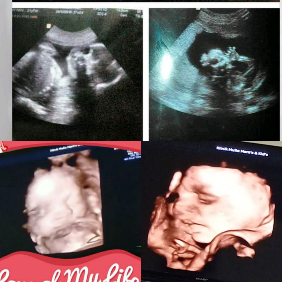 Novita Putri Agustin profile icon