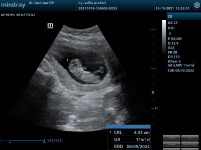 SELFIA PRATIWI profile icon