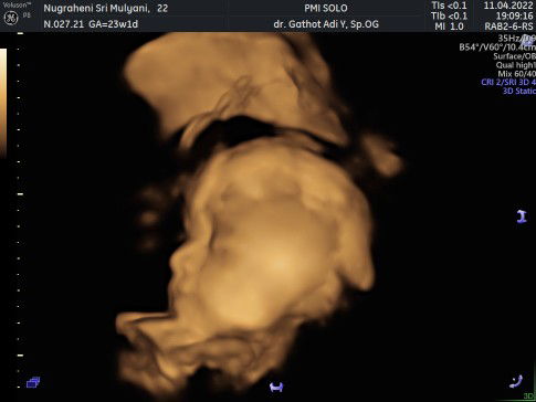 Nugraheni srm profile icon