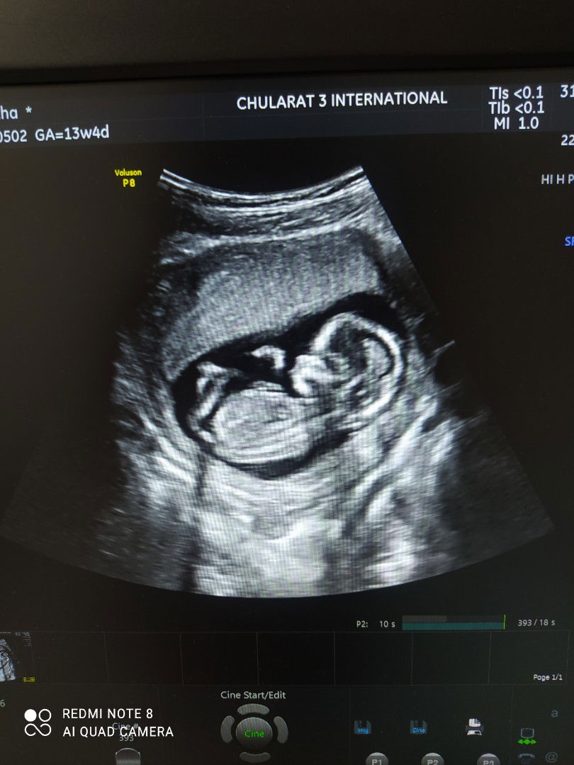 Nattha Arbram profile icon