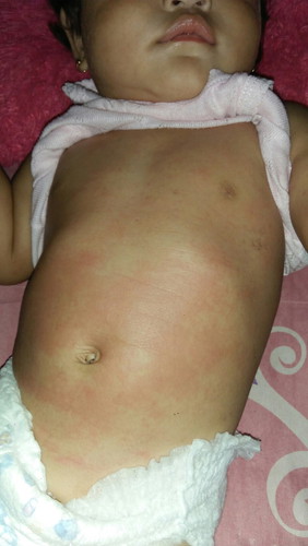 perut dan punggung merah..