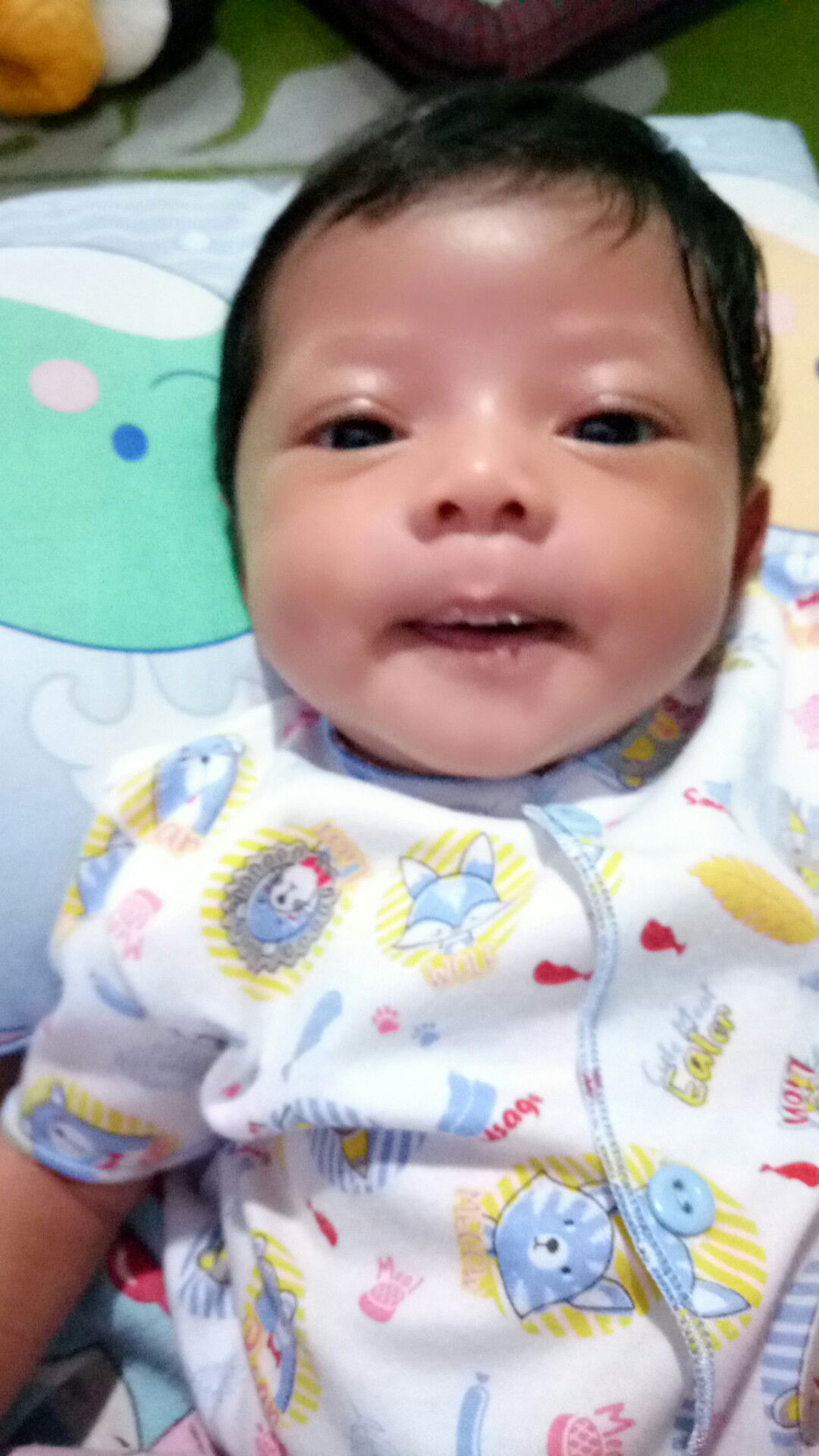 Bayi Usia 1 Bulan, Tidak BAB sdh 5hari