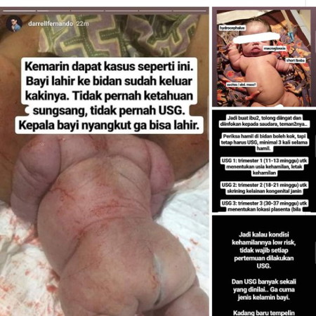 pentingnya usg