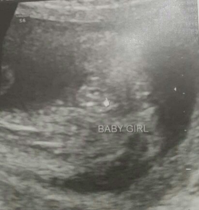baby girl name ❤