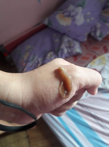 mucus plug?? 38Weeks 3Days