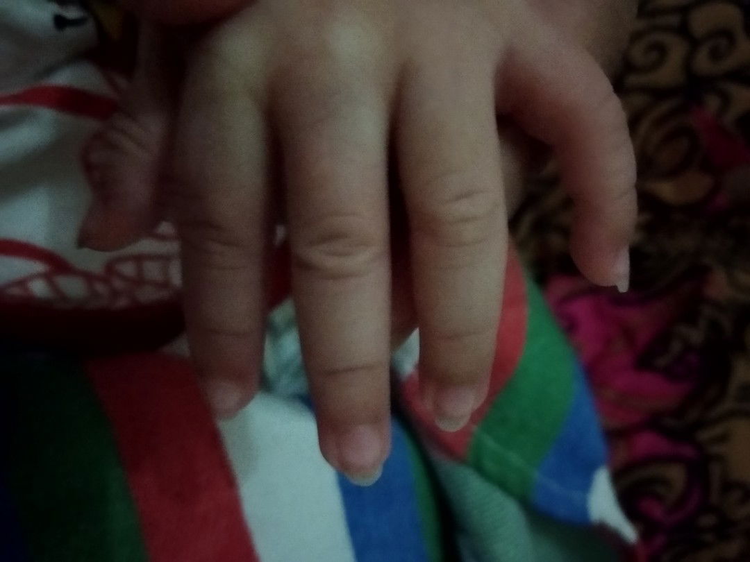 Gunting kuku bayi new born