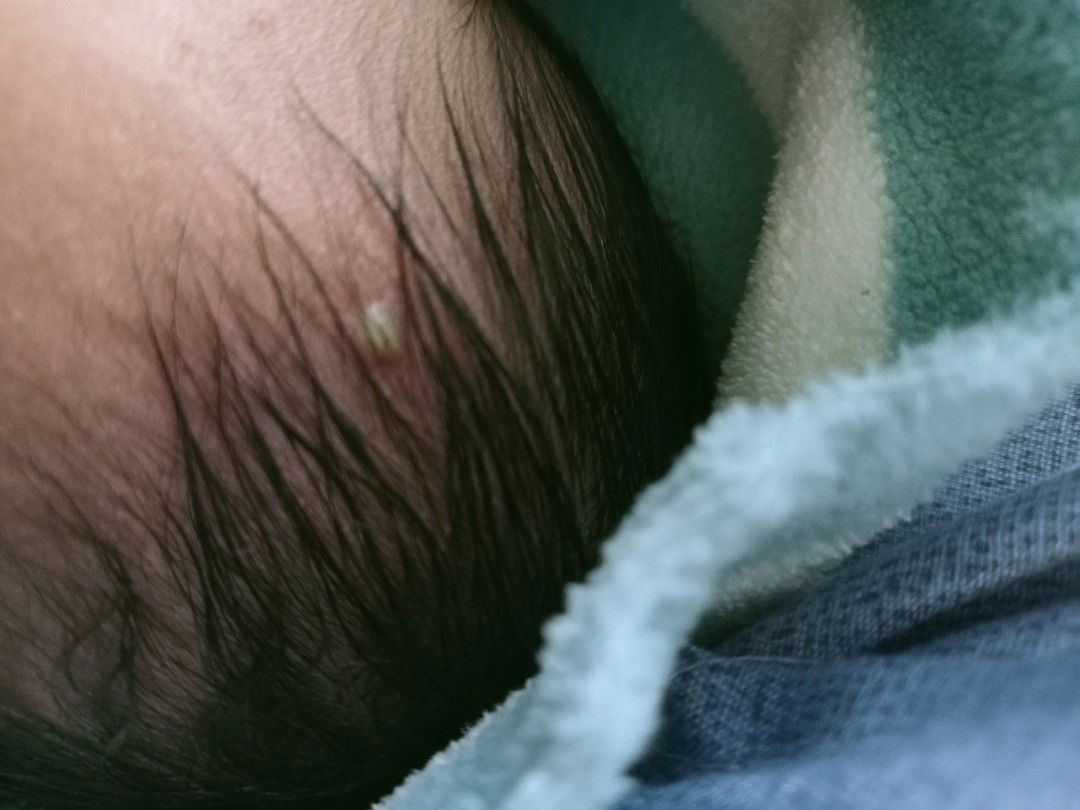 Nagka ganito po ba baby niyo? Ano po kaya pwede gamot dito?