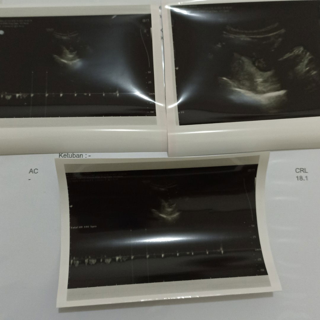 Nurul Holipah profile icon