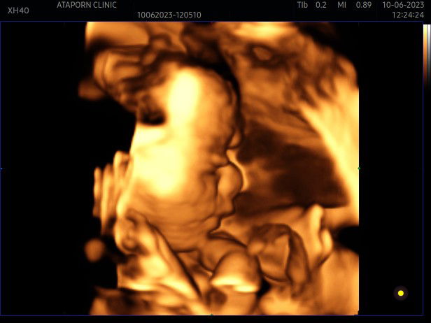 Anusara Homklang profile icon