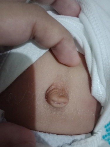 umbilical cord