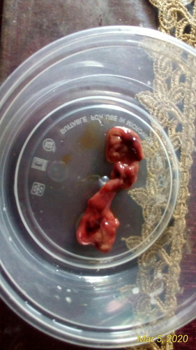 8 weeks pregnancy