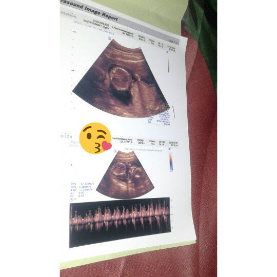 hamil 16 week uda ngerasain apa aja bun?