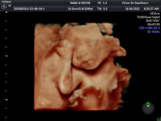 สิรินทรา profile icon