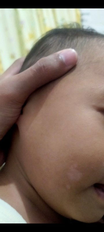 Bund mau tanya obat/salep yg cocok buat kulit anak seperti itu apa ya..tolong bantu ya bun.terimkash