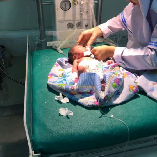 bayiku lahir di usia kandungan 30 minggu 1 hari