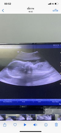 ศิริลักษณ์ ฤทธิ์เดช profile icon