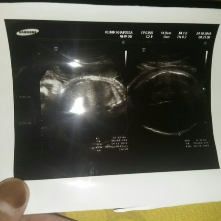 39week