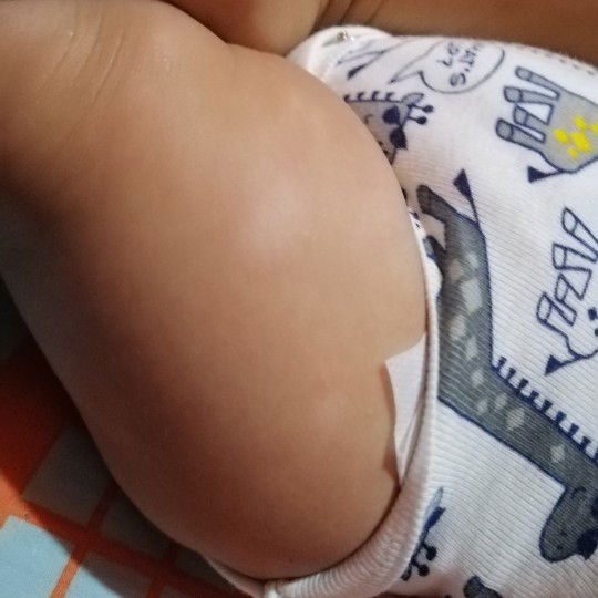 Sinong Baby Nila Nakaranas Nito