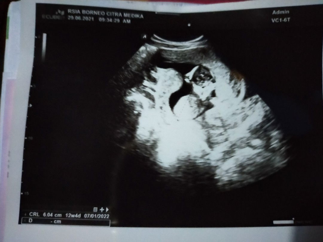 kartika andini profile icon