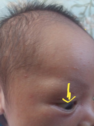 worried mommy here help please