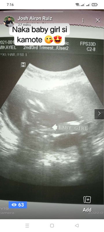 Mikayiel De Guzman profile icon