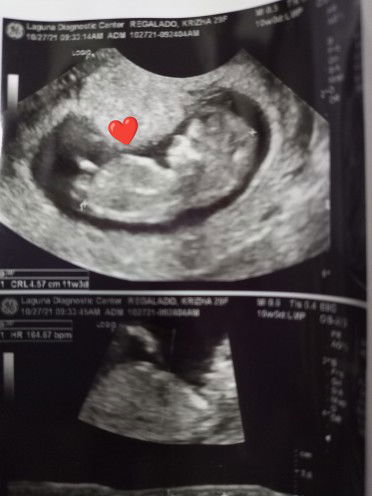 Krizha Mae profile icon