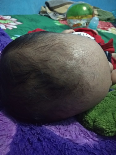 Ubun ubun bayi
