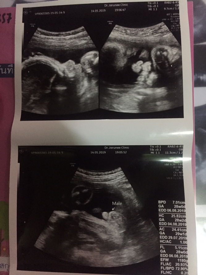 #ร่วมกิจกรรม #ความประทับใจ