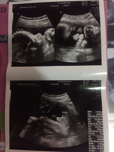 #ร่วมกิจกรรม #ความประทับใจ