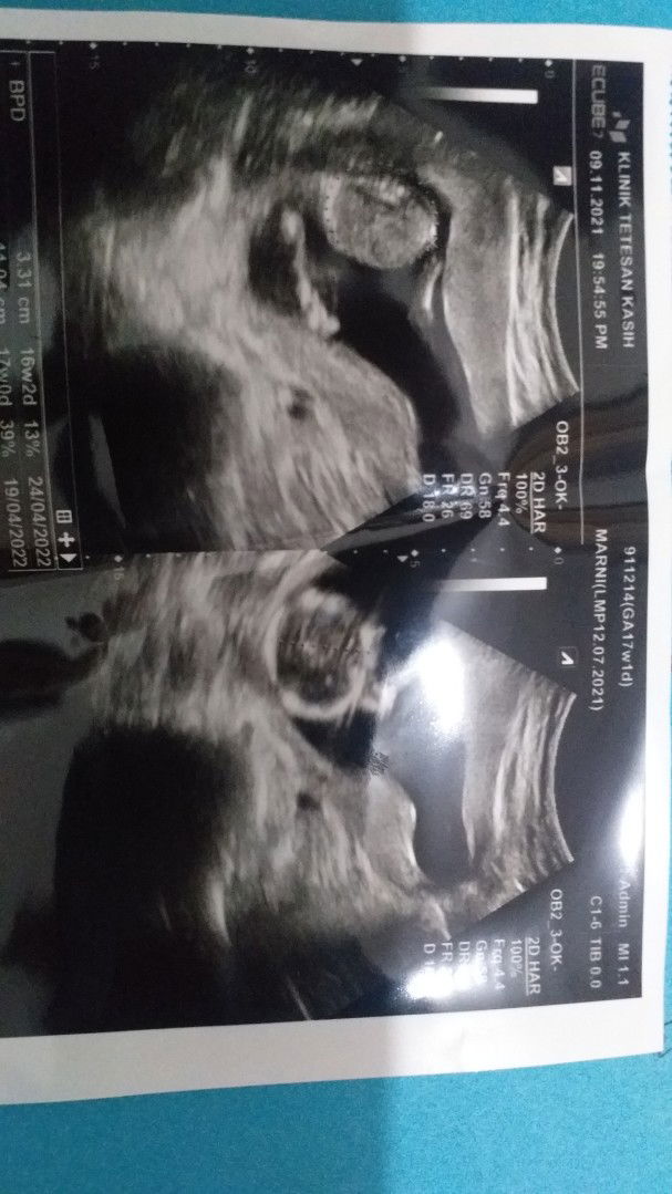 ArnyNtt profile icon