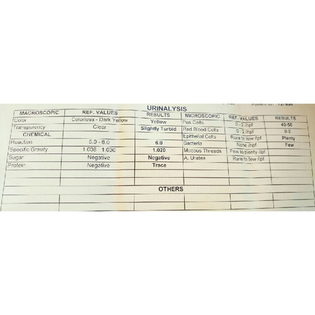urinalysis