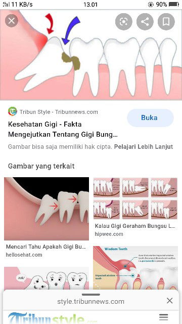 apakah gigi bam belakang tumbuh harus operasi?