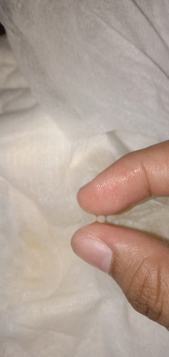 baby pee