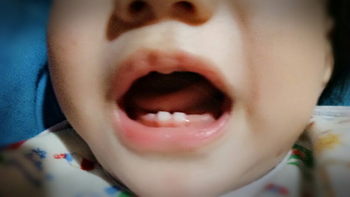 Teething