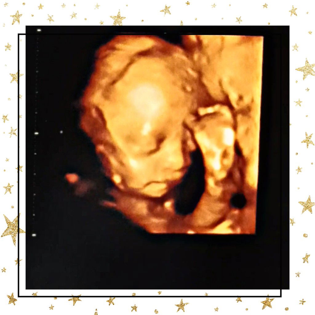 Octaviani Wahyuvera profile icon