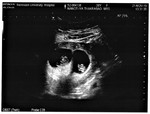 Nonthiya Thakrabao profile icon