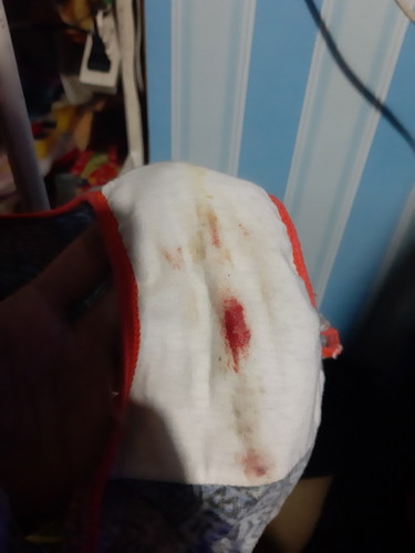 Blood in my panty