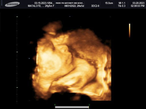 Regina Grace Matalote profile icon