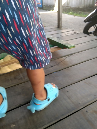 Krim/salep bekas koreng