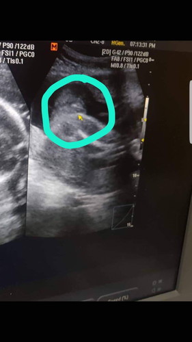 girl or boy