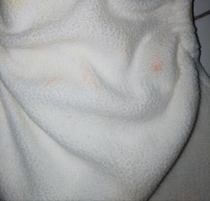 bercak merah di popok