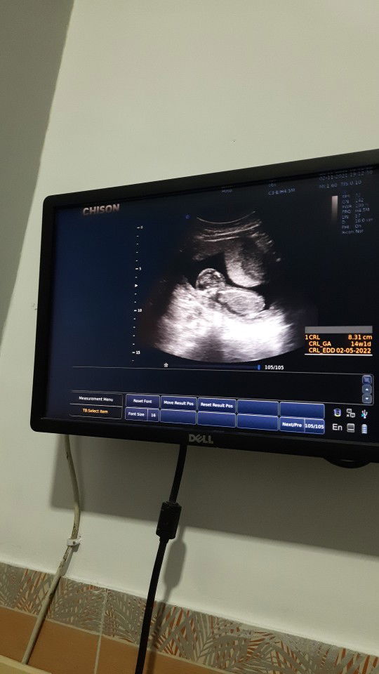 Melinda y. putri profile icon