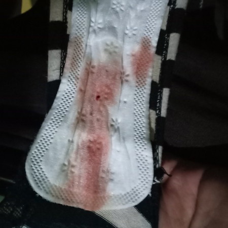 sorry for the pic po.